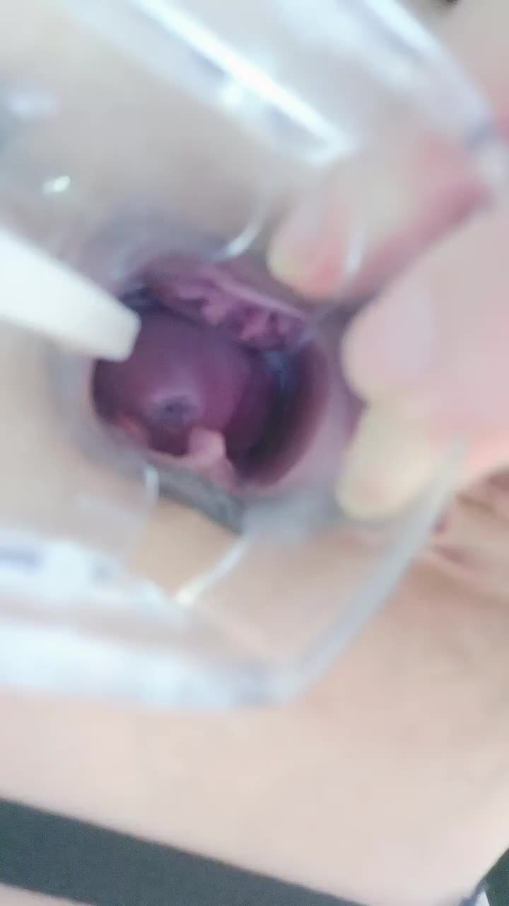 1 (9)