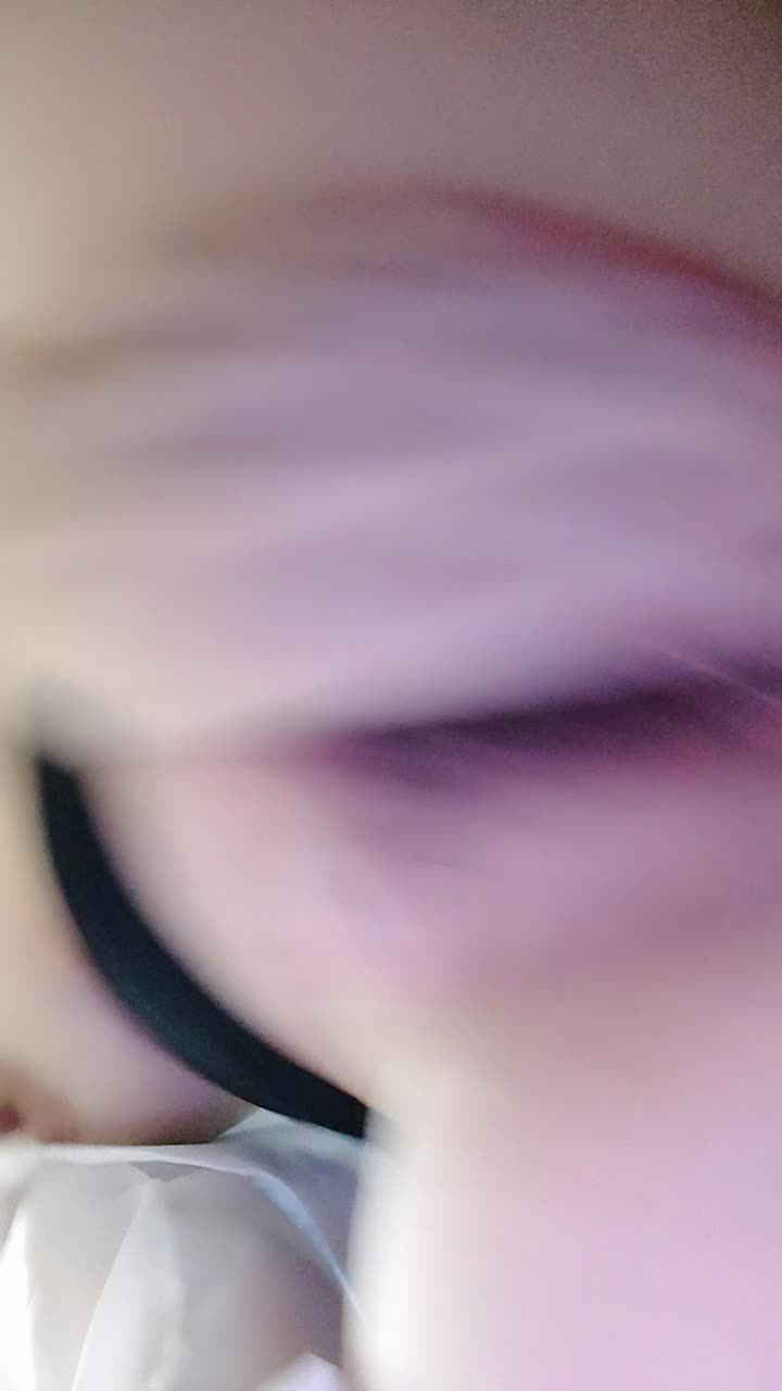  (18)
