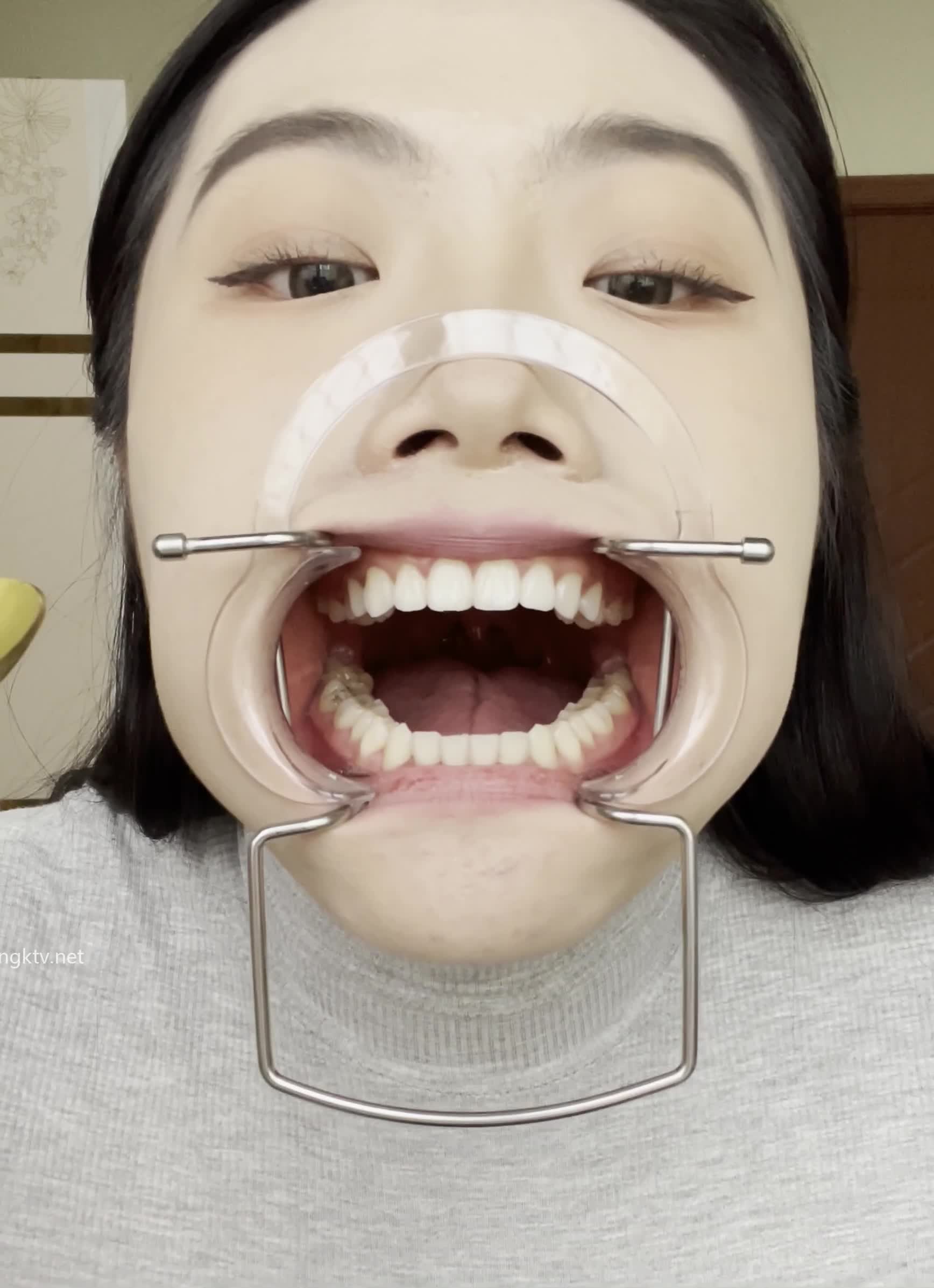 1 (1)