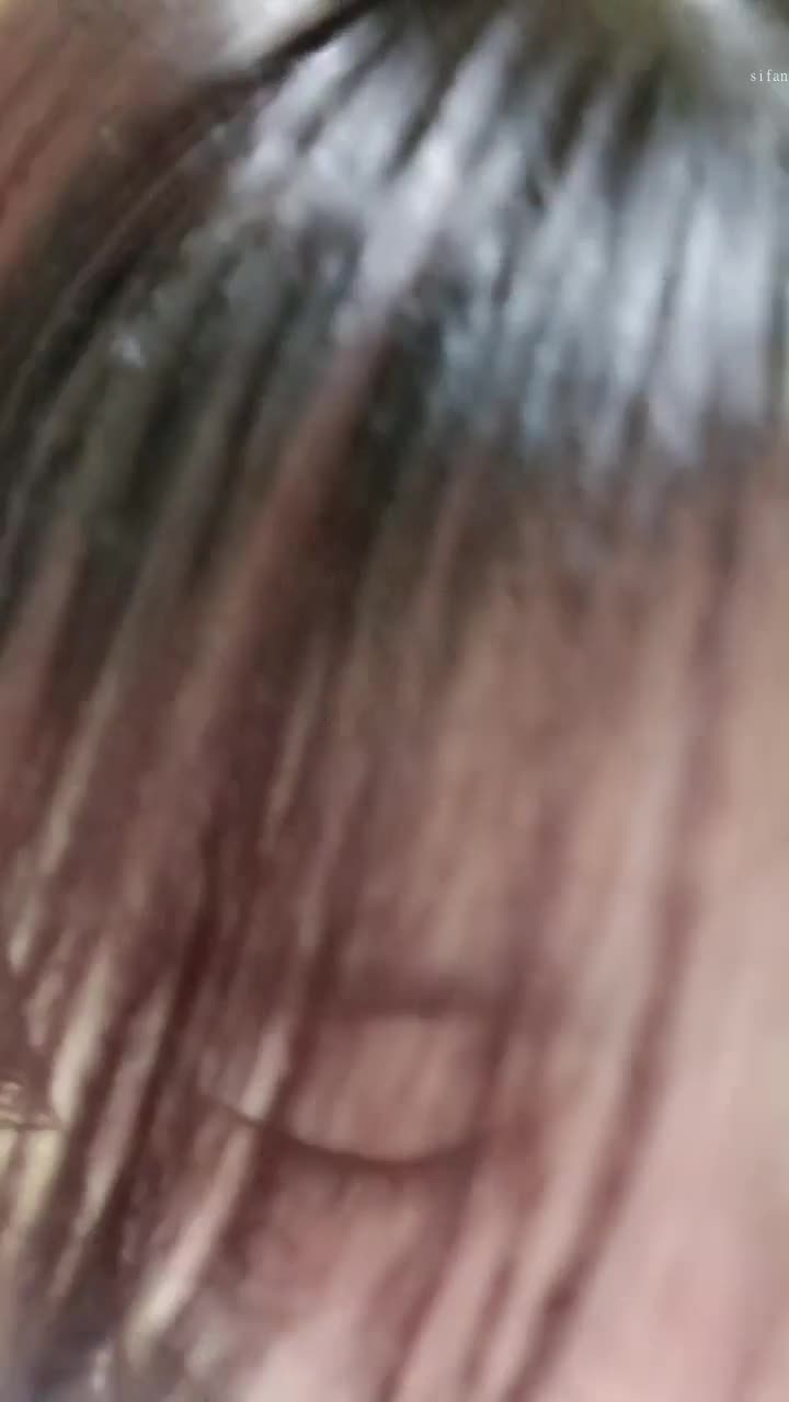  (17)