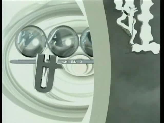  (1)